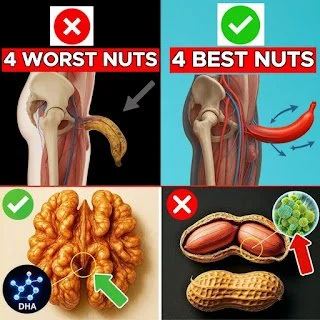 A selection of nuts with labels indicating best and worst choices for senior health.
