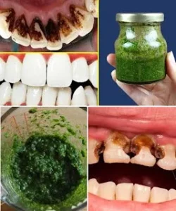Tube of peppermint toothpaste for fresh breath and dental health